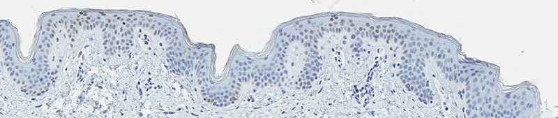 TREATED-SKIN-FOUR-HOURS-WITH-PROTEXIDINE