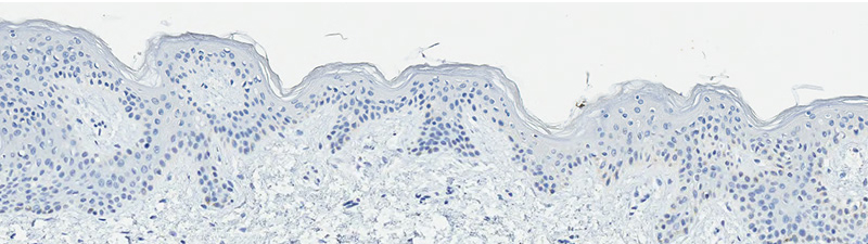 TREATED-SKIN-TWELVE-HOURS-WITH-PROTEXIDINE