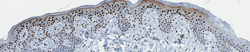 UNTREATED-SKIN-FOUR-HOURS-WITHOUT-PROTEXIDINE
