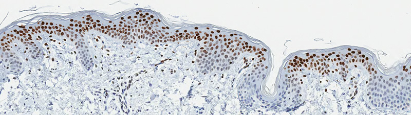 UNTREATED-SKIN-TWELVE-HOURS-AFTER-PROTEXIDINE